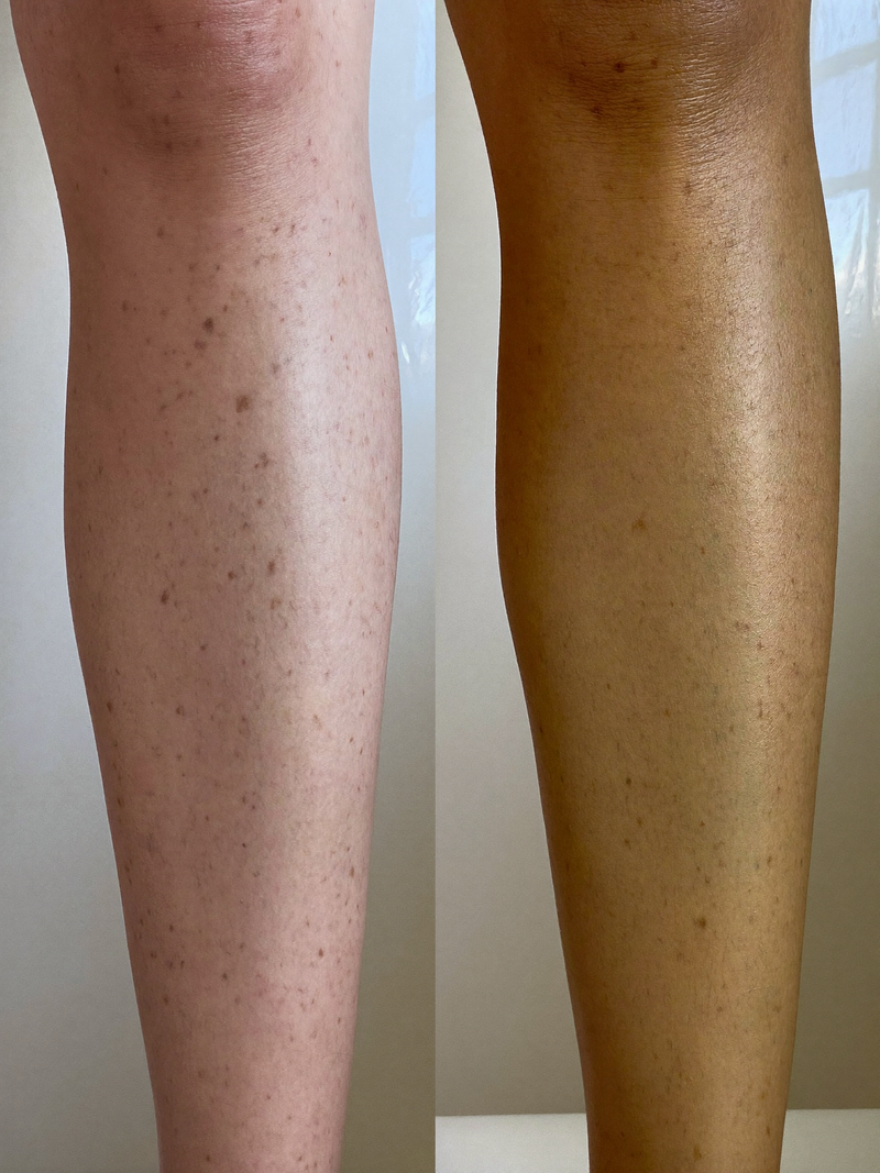Result shins before and after