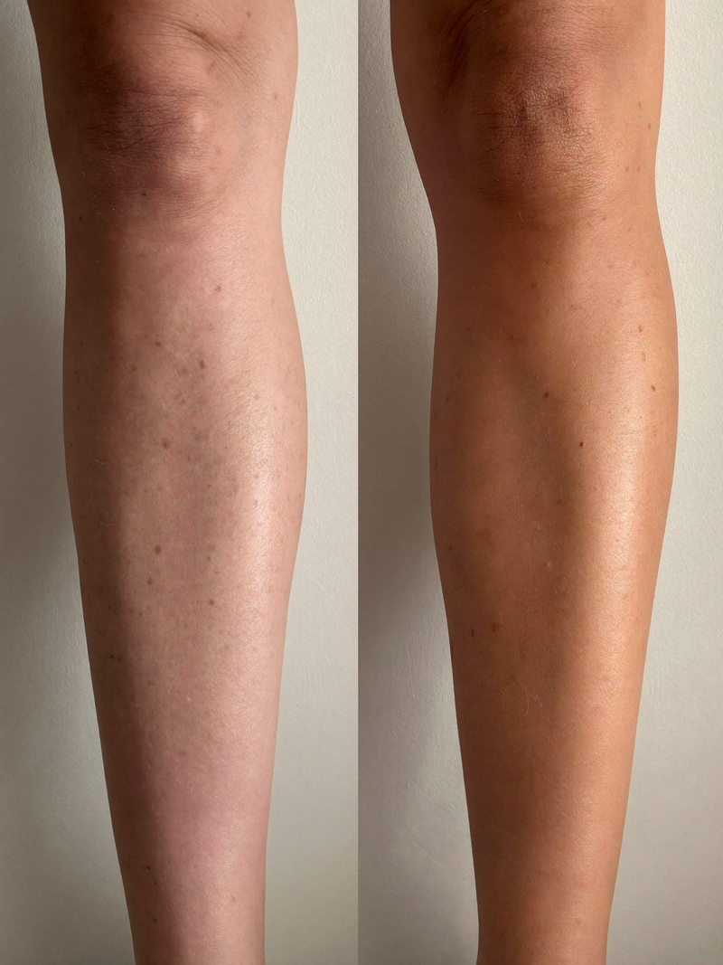 Result legs before and after