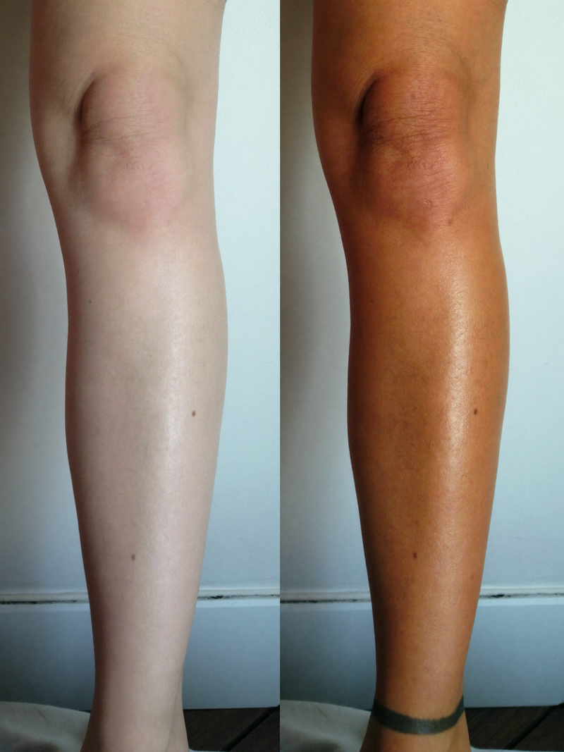 Result calf before and after